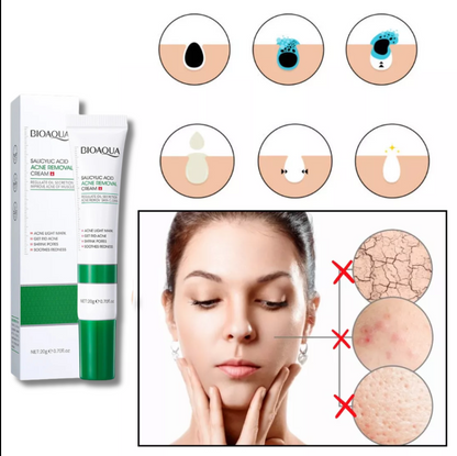 Crema Antiacné con Ácido Salicílico Bioaqua