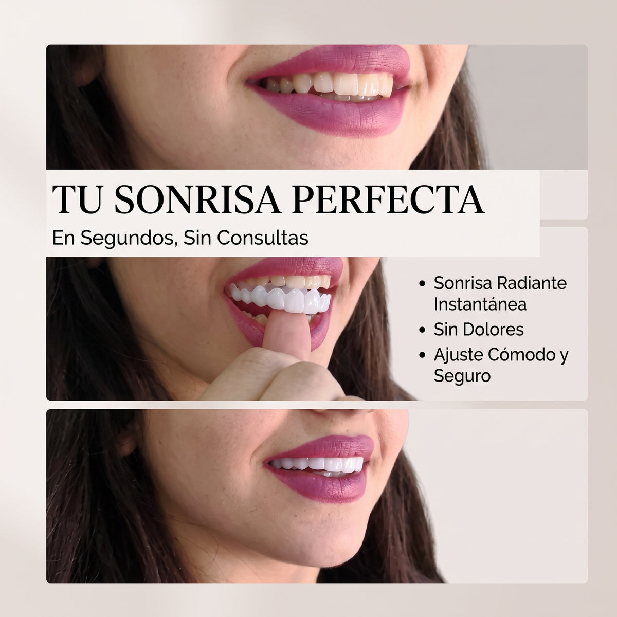 Implantes Dentales (Superior+Inferior)
